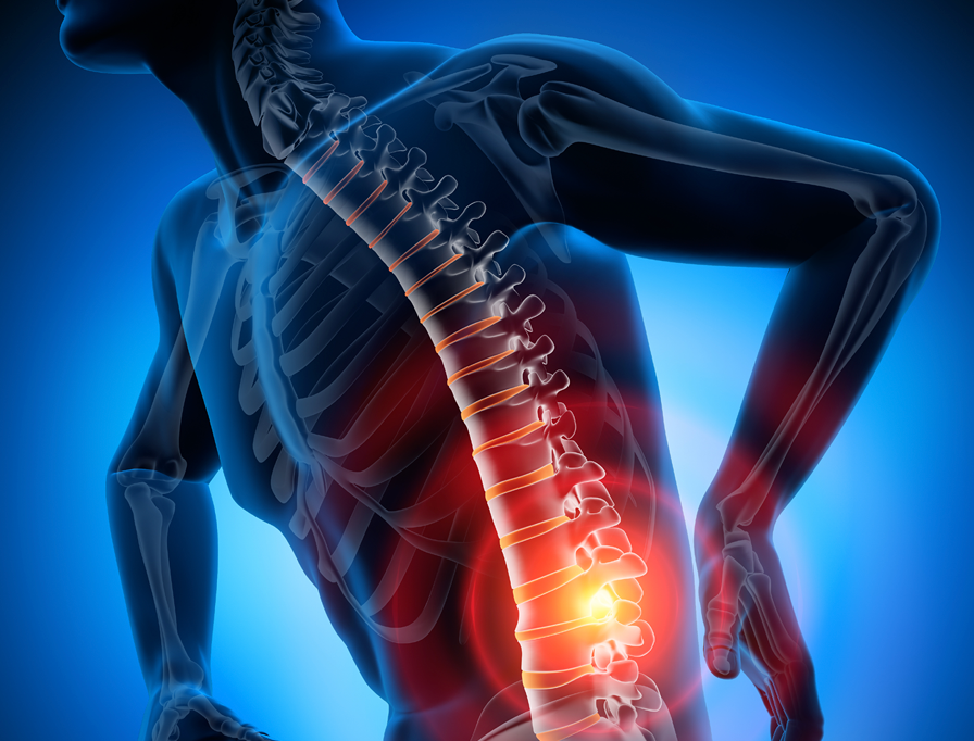 Anatomical 3D illustration highlighting lower back pain along the spinal column on a blue background.   